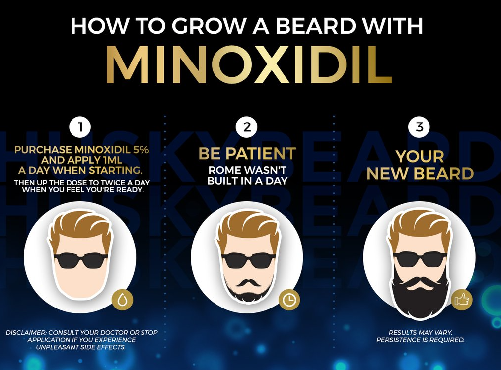 Matu ārstēšana ar Minoxidil